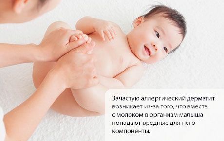 Алергічний дерматит у дитини
