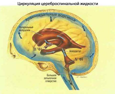 Підвищений внутрішньочерепний тиск 