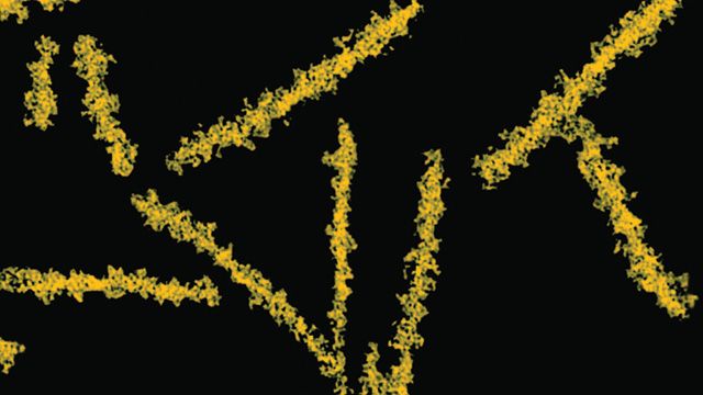 Пріони – збудники пріонних захворювань
