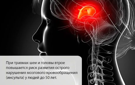 Ризик інсульту зростає в перші місяці після травми голови або шиї